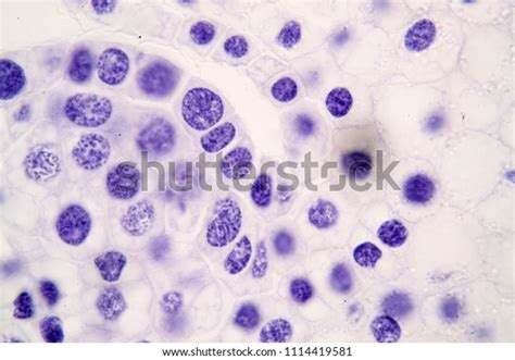 Image result for Splitting Cells Microscope