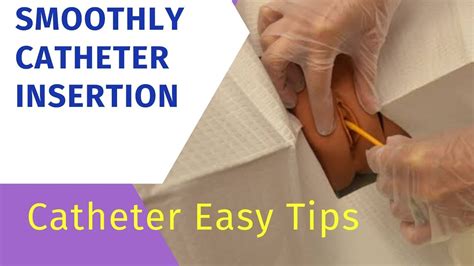 Toradh íomhá ar How to Use a Straight Catheter