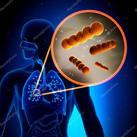 Image result for Strep Gram-positive