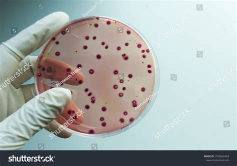 Image result for Coliform Test Microbiology