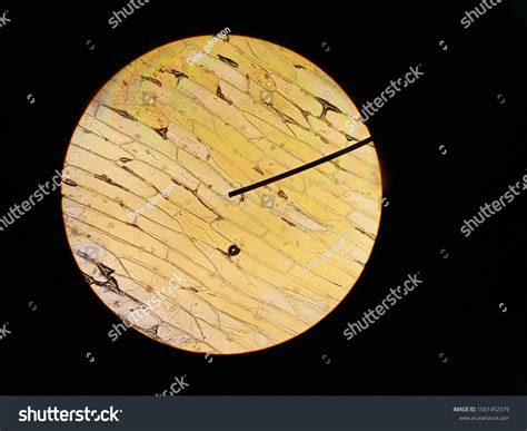 4X Microscope View എന്നതിനുള്ള ഇമേജ് ഫലം