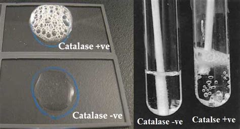 Image result for Catalase Test Lab Report