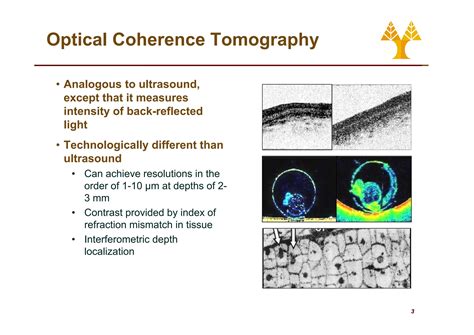 Image result for Optical Coherence Tomography Explained