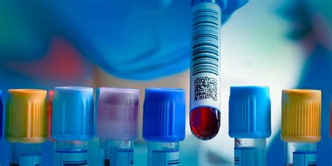 Image result for Kriteria Lead Compound