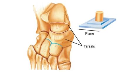 Image result for Structure of Gliding Joint