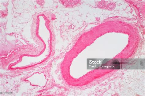Image result for Hypophyseal Artery Under Microscope