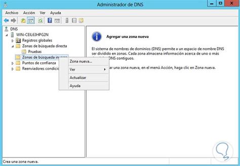 Afbeeldingsresultaten voor DNS Zonen