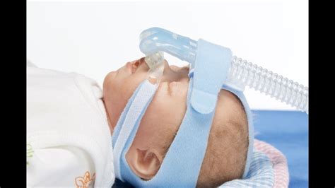 Image result for Newborn CPAP