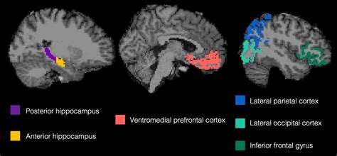 MRI Scanner Prefrontal Cortex に対する画像結果