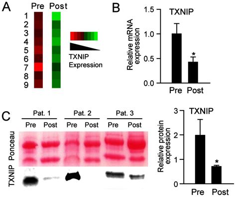 Toradh íomhá ar mRNA Microarray Analysis