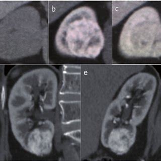 Solid Pattern Diagram に対する画像結果