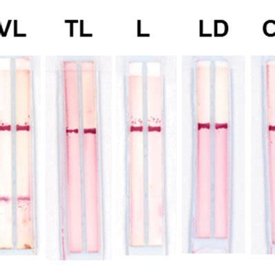 Image result for What Is a LFD Test