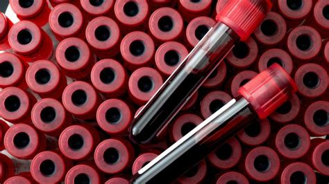 Image result for What Is Medicine