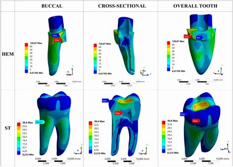 Image result for Finite-Element Modeling Concept