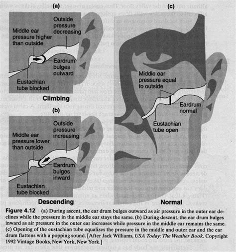 Image result for Cold Pressure in Ear
