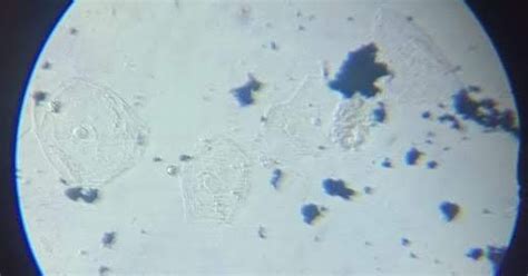 Dr Ranjana: Mitochondria in cheek cell stained by Janus green B in ...