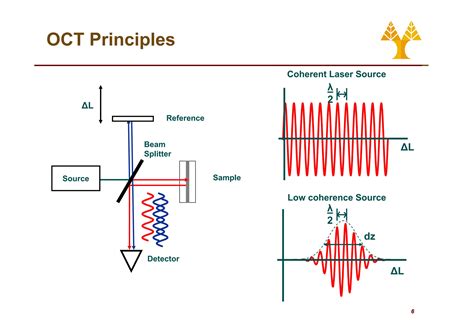 Image result for Optical Coherence Tomography Explained