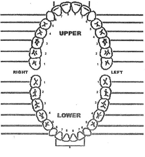 Toradh íomhá ar Dental Charting Practice Examples
