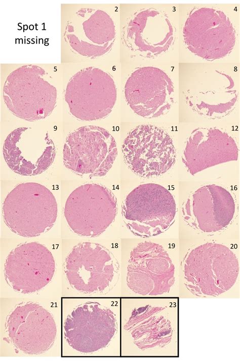 Image result for Tissue Microarray TMA Equipment