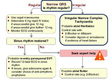 Toradh íomhá ar Advanced Cardiac Life Support Tachycardia Algorithm