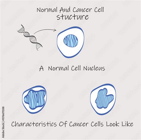 Image result for Cancer Cell Structure