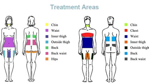 Image result for CoolSculpting Machine