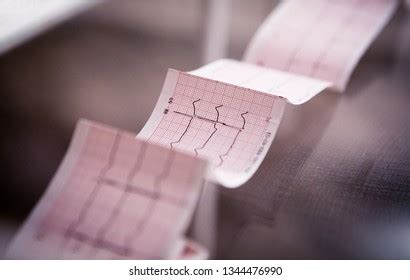 Image result for Heart Rythum Simulatar