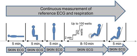 Afbeeldingsresultaten voor ECG Study
