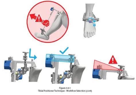 Afbeeldingsresultaten voor Computer Assisted Instrument Definition