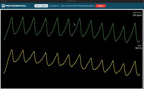 OpenView GUI に対する画像結果