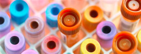 Image result for WBC Count