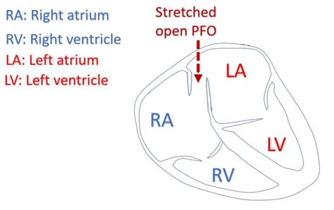 Image result for Open PFO File