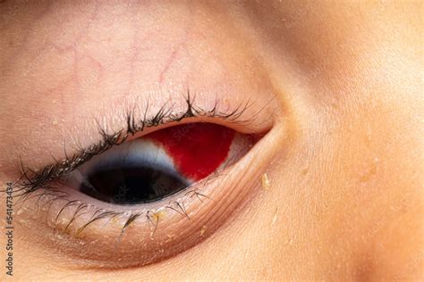 Image result for Blood On Eyes VFX