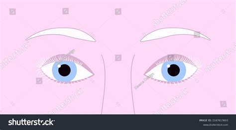 Light Blue Eyes Albinism に対する画像結果