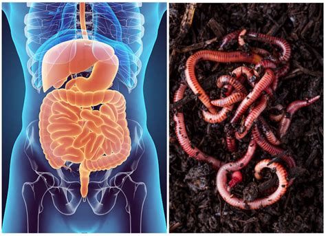 Image result for Worms in Humans