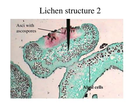 Image result for Lichen Ascocarps Cell Labeled