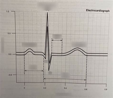 What Does a Normal ECG に対する画像結果