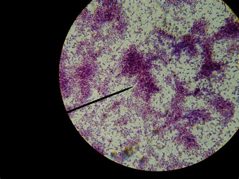 Afbeeldingsresultaten voor Acid-Fast Bacilli Slide Control