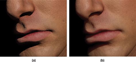 Skin Subsurface Map に対する画像結果