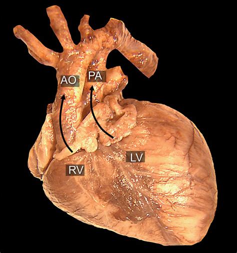Afbeeldingsresultaten voor Corrected Transposition