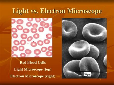 Light Microscope vs Electron Microscope Cells に対する画像結果