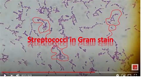 Image result for Strep Gram-positive