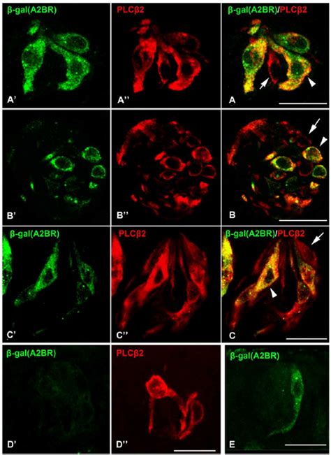 Image result for Signalling Pathway plc Type 2 Taste Cells