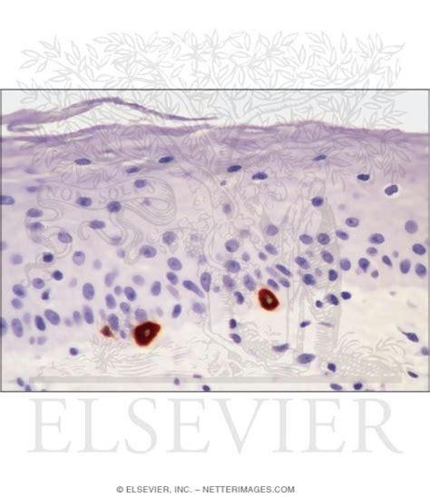 Afbeeldingsresultaten voor Merkel Cell Light Microscopy