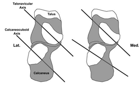 Subtalar Axis に対する画像結果