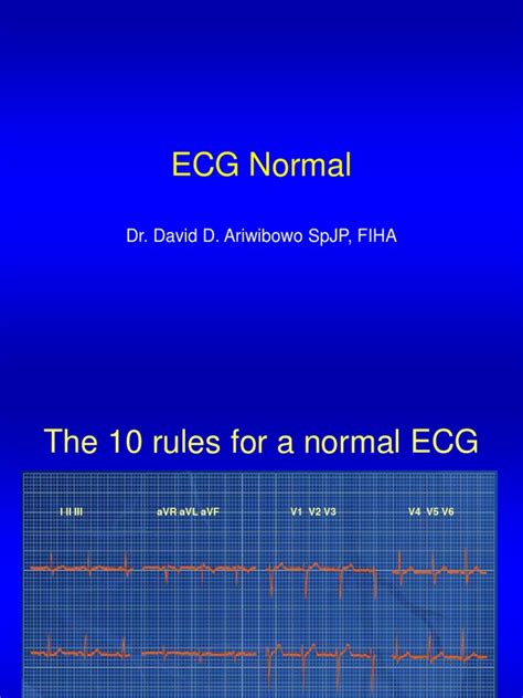 The Ten Rules for a Normal ECG: Identifying Key Characteristics of ...