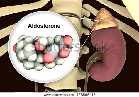 Toradh íomhá ar Conn Syndrome