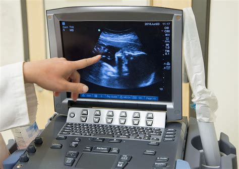 Ultrasound Student に対する画像結果