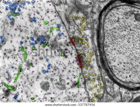 Toradh íomhá ar Electron Microscope False-Color