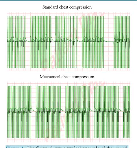 Image result for Chest Compression UI Graph
